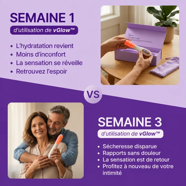 vGlow™ Soin Intime vue 5